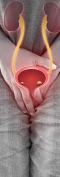 urinary-incontince-3-GettyImages-1333948548-1-e1690616022549
